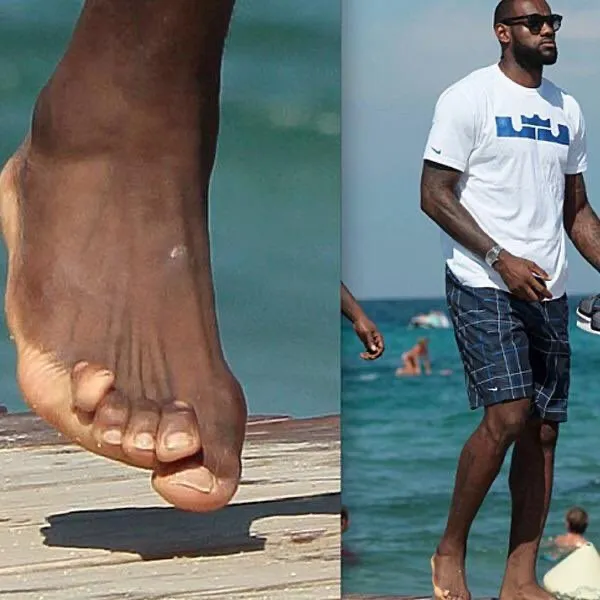 Bàn chân kỳ dị của LeBron James - Thể thao